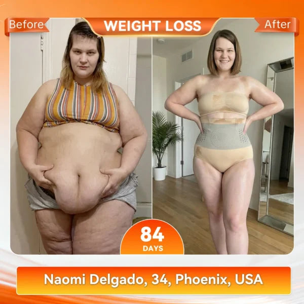 🥳2026 HOT SALE🥳💞50K+ SOLD!🌸🧘‍♀️ 50% OFF! Thermogenic Tummy Control Shorts-H